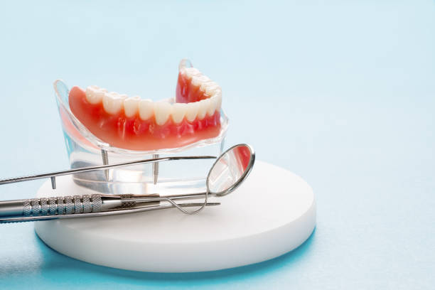 Full Mouth Reconstruction in Weedpatch, CA